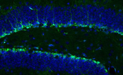 Neural stem cells in the mouse hippocampus shown in green (cell bodies shown in blue) give rise to new mature neurons throughout life. An image taken from a microscope with two thick bright green & blue lines on a black background.
